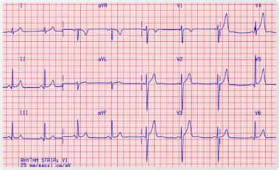 20090716143821-electrocardiograma2.jpg